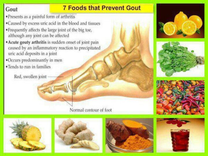 Foods that help Gout