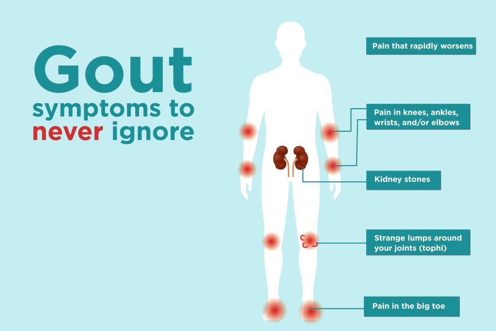 how-to-diagnose-gout-in-knee-goutinfoclub