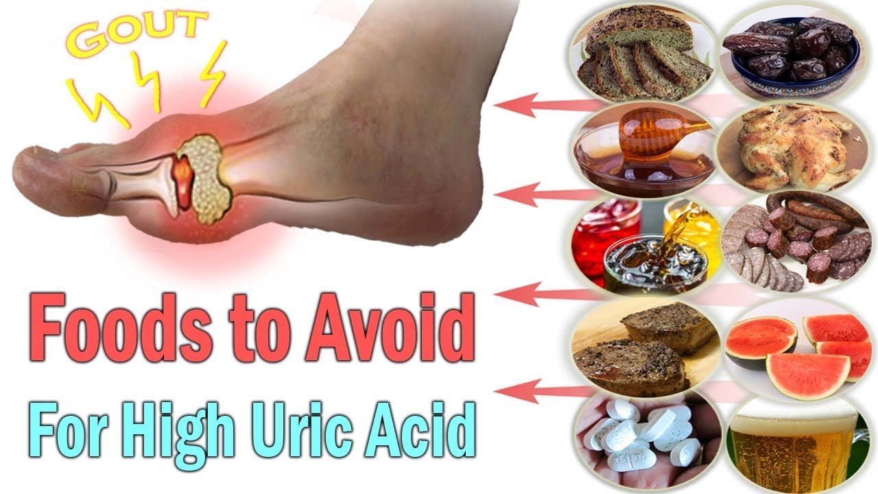 Foods High In Uric Acid Causing Gout 2343