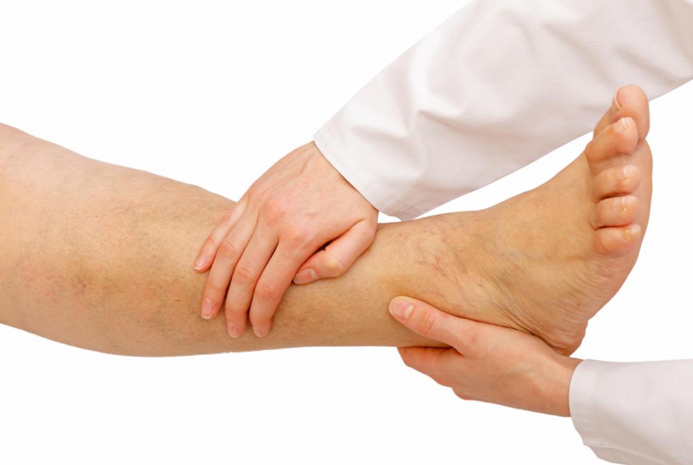 How Painful Is Gout In The Ankle